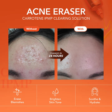 APRILSKIN Carrotene IPMP Spot Treatment