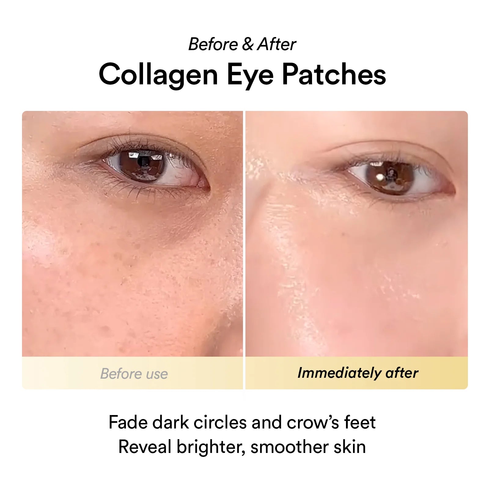 ABIB - Collagen eye patch