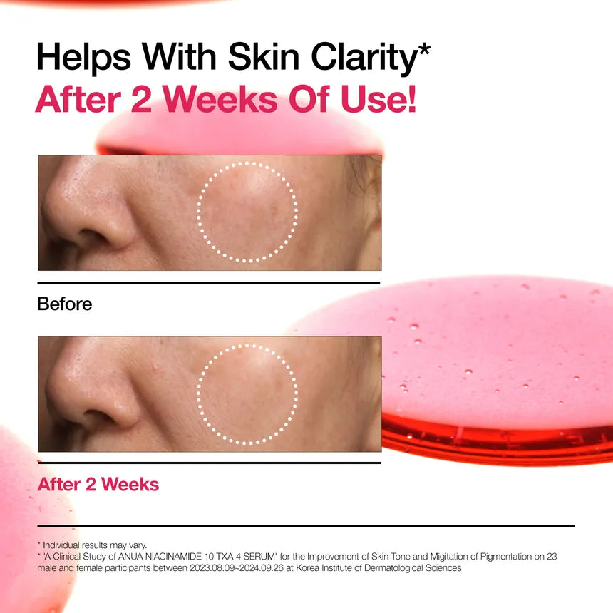 ANUA Niacinamide 10 TXA 4 Serum